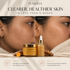 Anti-Blemish Routine